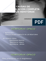 opacificación de hemitórax.pptx