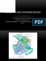 Sinusitis Bacteriana Aguda