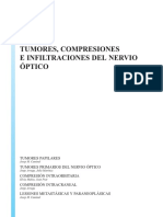 Tumores Compresiones e Infiltraciones Del Nervio Optico (3074)