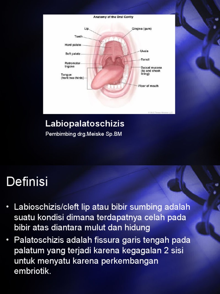 Labiopalatoschisis (Choi) | PDF