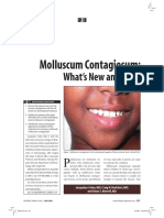 Molluscum Contagiosum:: What's New and True?