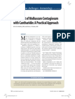 Treatment of Molluscum Contagiosum With Cantharidin: A Practical Approach