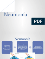 Neumonía