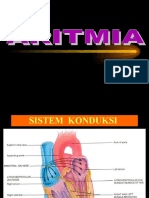 Ekg Aritmia