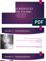 Tugas Radiologi Tumor Tulang