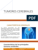 Tumores Cerebrales Liz