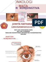 JUWITA RAYHANA (TUMOR KONJUNGTIVA).ppt