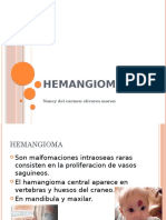 Hemangioma