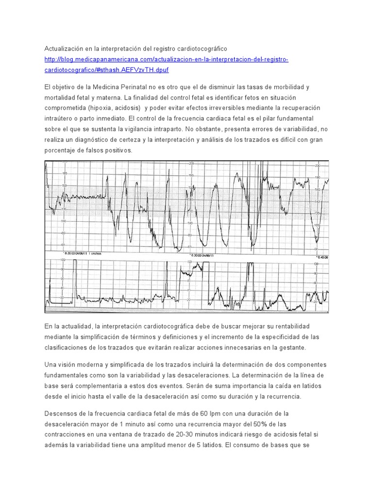 Interpretación Del Registro Cardiotocográfico HTTP | PDF