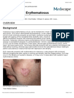 Discoid Lupus Erythematosus - Background, Etiology, Epidemiology