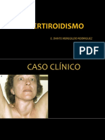 Medicina III - Hipertiroidismo