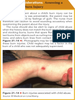 Assessing A Child With Burn Injury