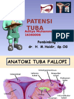 Patensi Tuba