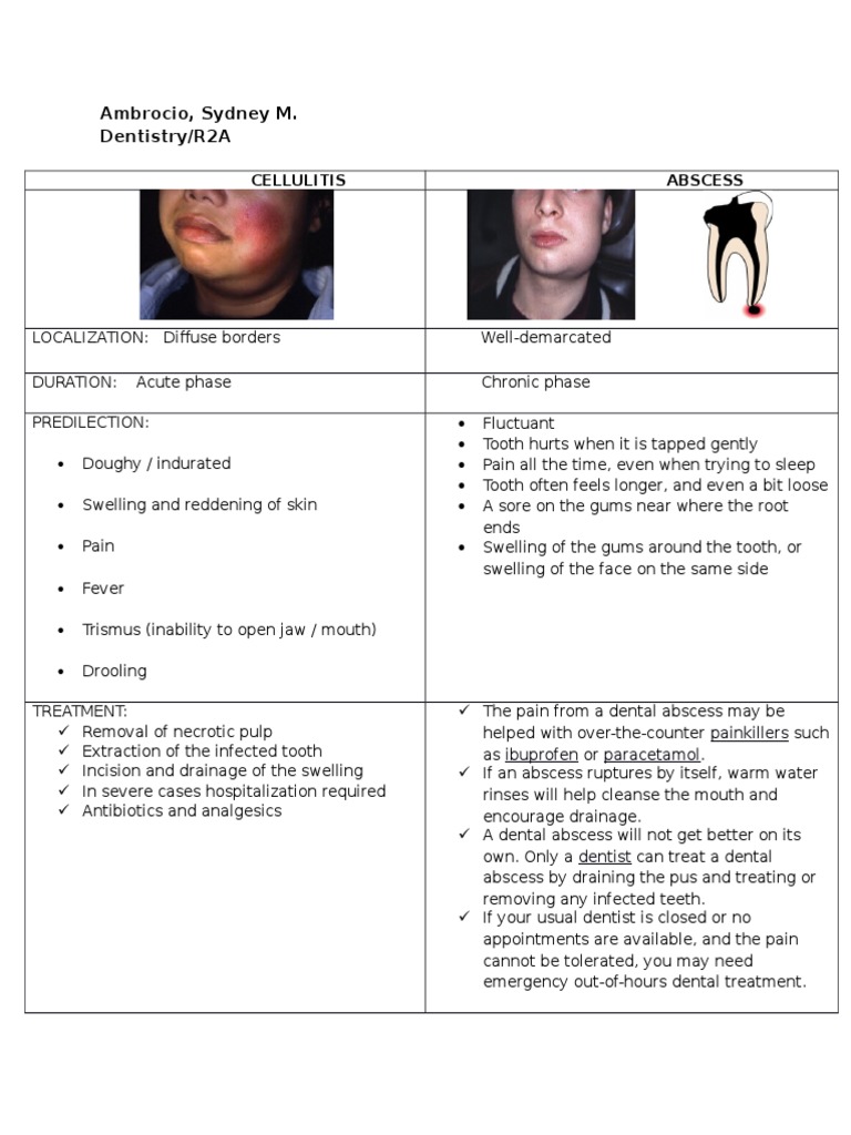 Dental Abscess: Symptoms and Treatment | PDF