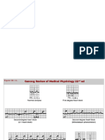 Cardiac Arrhytmias