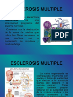 esclerosismultiple