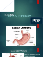 Kasus.pptx