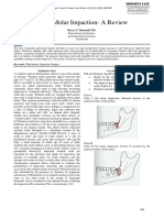 Third Molar Impaction-A Review: Divya.T, Themozhi M.S