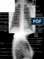 Thorax Foto