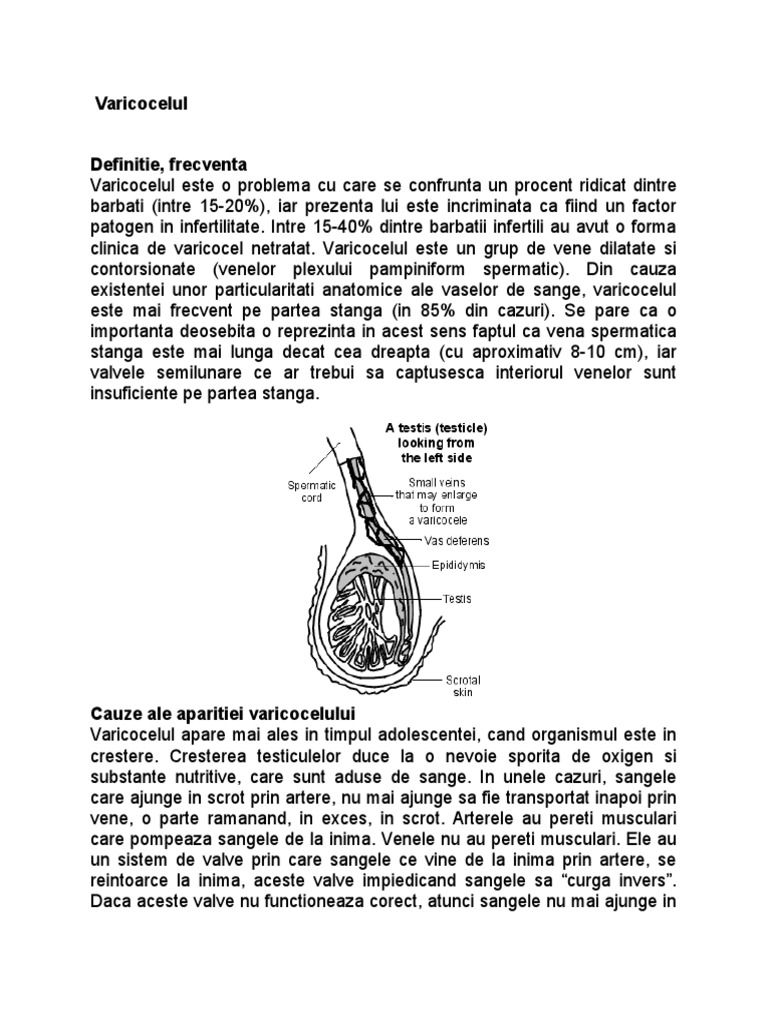 VARICOCEL | PDF