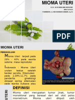 Mioma Uteri 2