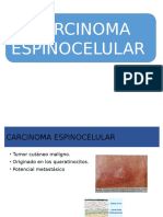 Cb y Espinocelular