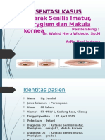 Presentasi Kasus MATA