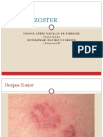 Herpes Zoster