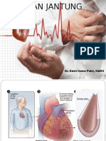Serangan Jantung