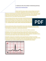 Download Cara Mudah Membaca Gambaran EKG Atau Rekam Gelombang Jantung by NurRismaUfadillaII SN347292206 doc pdf