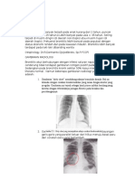 Radiologi Bronkitis