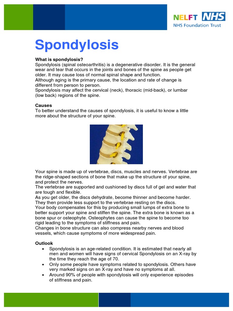 Spondylosis Information Leaflet PDF Vertebral Column Clinical
