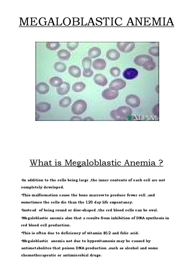 Megaloblastic Anemia (Group 4) PDF Anemia Vitamin B12