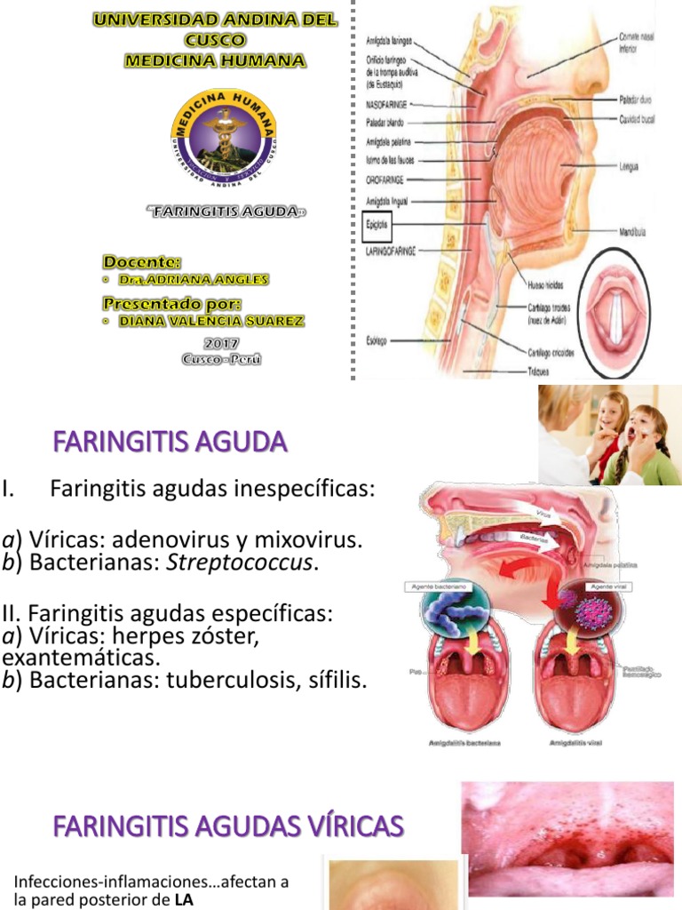 Faringitis Aguda: Tipos y Tratamientos | PDF | Inmunología | Medicina ...