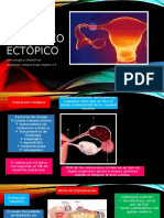 Ectopic o