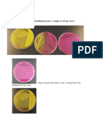 MSA TEST - Used For Identifying Gram + Staph or Strep Cocci: Pink Color For Msa S. Epi Negative For Fermentation and