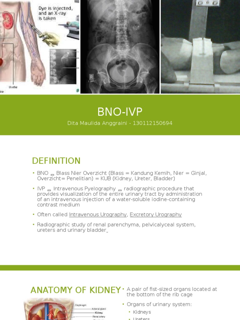 Bno Ivp | PDF