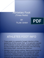 Athletes Foot: (Tinea Pedis)