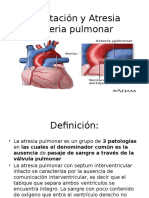 Coartación y Atresia Arteria Pulmonar