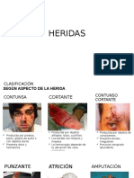 HERIDAS