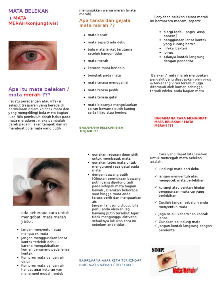 Mata Belekan Leaflet