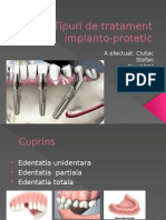 Tipuri de Tratament Implanto-protetic