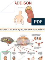 Enfermedad de Addison - Alburuqueque Estrada Néstor