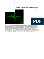 How To Read An EKG (Electrocardiograph)