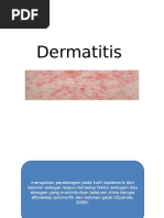 Fitoterapi Dermatitis Tinea Versicolor