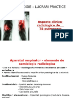 Aspecte Clinico-radiologice de TB Pulmonara - Scurtat