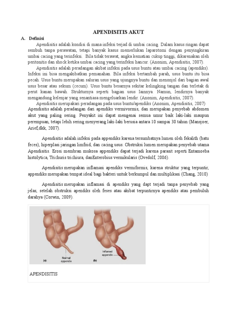 Panduan Lengkap Apendisitis Akut | PDF | Pengembangan Diri | Kesehatan ...