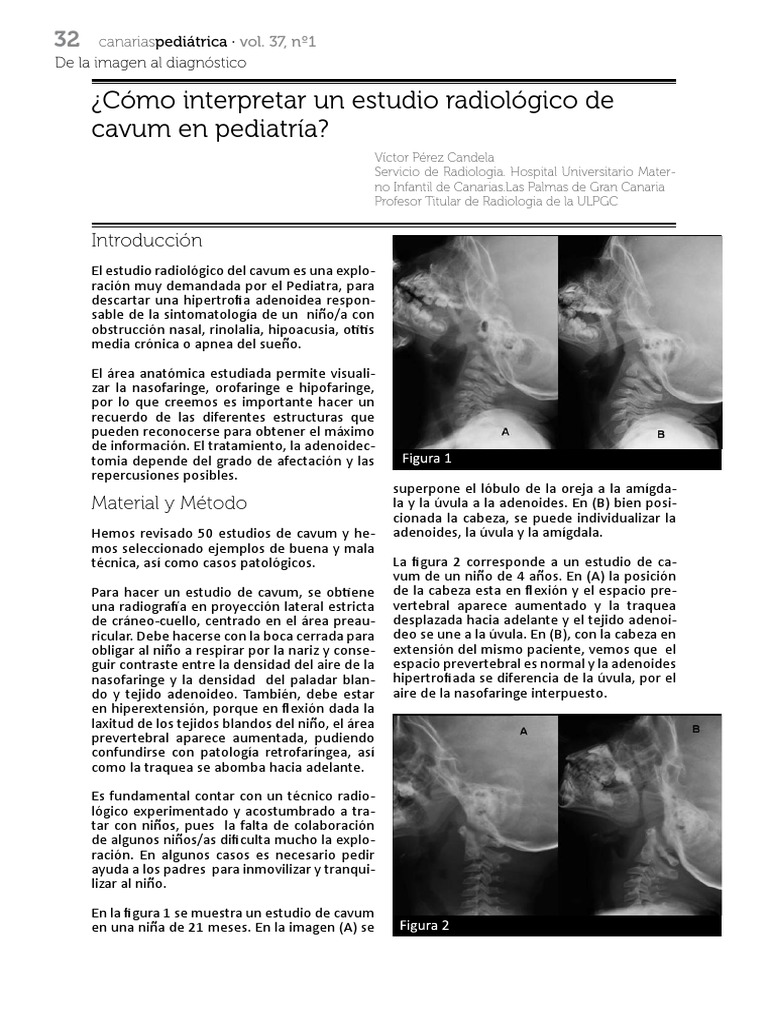 Interpretación de radiografías de cavum | PDF | Enfermedades y ...