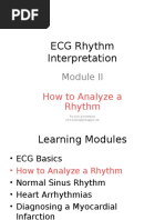 ECG Rhythm Interpretation: How To Analyze A Rhythm