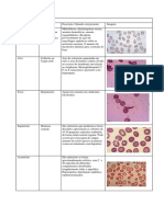 Alterações Eritrocitárias